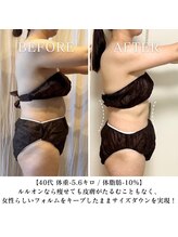 ヨサパーク エラ 恵比寿西(YOSA PARK Ella)/痩せないは年齢のせいじゃない！