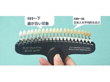 エール(aile)/嘉手納町セルフホワイトニング
