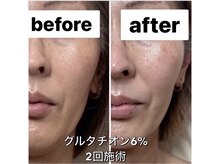 ナチュラ ソース(NatureSouce)/ホワイトニング、美白