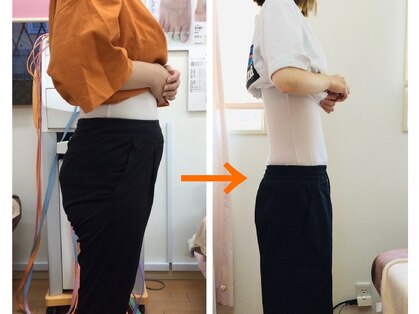 美容整体スズキ(SUZUKI)の写真