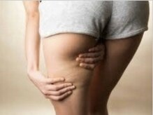 ヨサパーク ビューティスマイル(YOSAPARK BeautySmile)/◆太もも