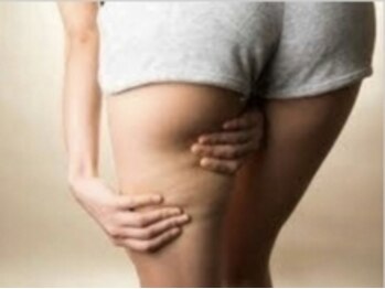 ヨサパーク ビューティスマイル(YOSAPARK BeautySmile)/◆太もも