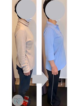 リベスト(RE:BEST)/当院の<全身矯正メニュー>効果