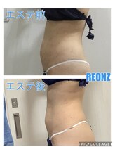 リオンズ 茨城ミスターマックス取手店/横から見てもすっきり☆