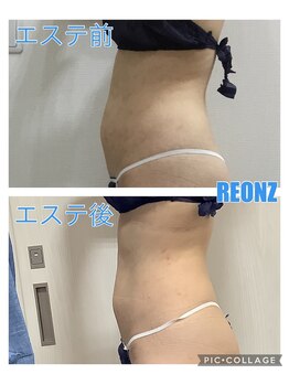 リオンズ 茨城ミスターマックス取手店/横から見てもすっきり☆