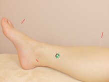 ミロクの里鍼灸院 東長崎店/【鍼灸施術】【東長崎】