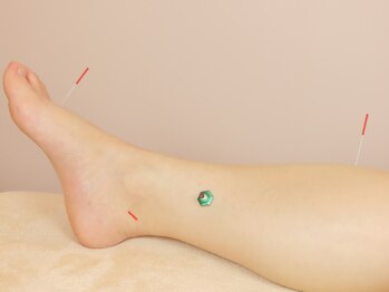 ミロクの里鍼灸院 東長崎店/【鍼灸施術】【東長崎】