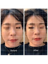 うめきた鍼灸院 センス(SENSE)/ビフォーアフター