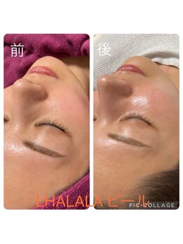 ビューティーサロン キャンディ 海老名(Candy)/