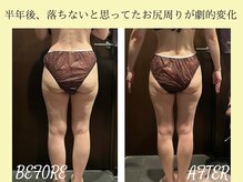 ザ モアナテラス(THE MOANA TERRACE)/小尻、脚のサイズダウン