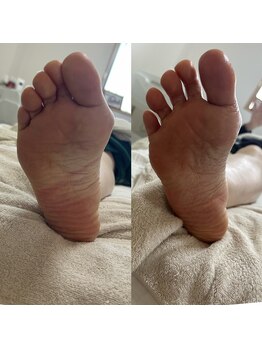 サロン サルー(SALON Salud)/◇足ツボ×調整