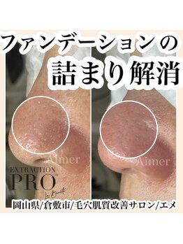 エメ(Aimer)/最新毛穴ケア