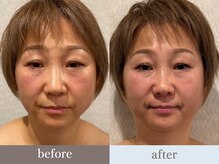 ビューティースタジオ韓美 銀座店/お客様のbefore/after