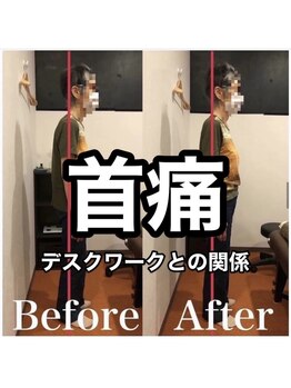 カワル整体 上通り院/デスクワークによる首痛...