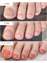 ケアプラス(care plus)/シェラックネイル