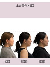 プティパ(Petit Pas)/AGOメソッド