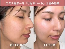 マリナビューティーサロン(Malina BEAUTY SALON)の雰囲気（毛穴レス＆韓国ツヤ肌◎ワントーンUPで美肌を目指す施術）