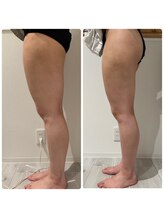 ルナグランデ(Luna grande.)/効果写真