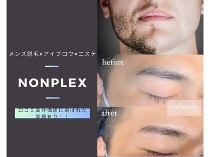 ノンプレックス(NON PLEX)の写真