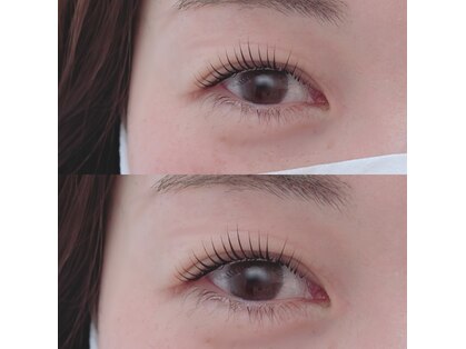 ヒビ(hibi)の写真
