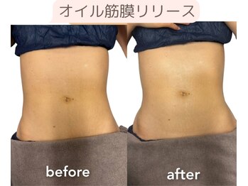 藍/筋膜リリース