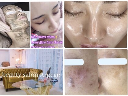 アルページュ(Arpege)の写真