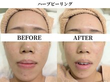 サンビ(SANBI)/トーンUPも同時に叶う肌質改善！