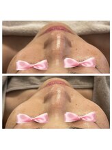 美温(mion)/おまかせフェイシャル