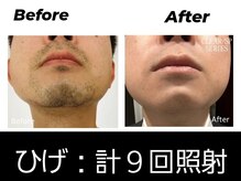 メンズ キガルモ 小山店