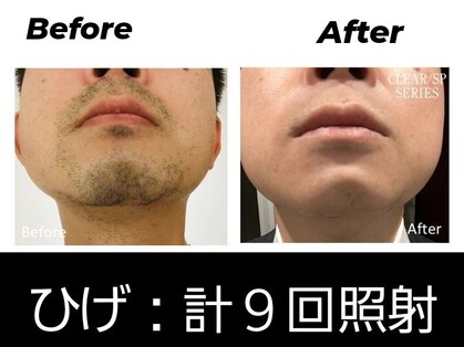 メンズ キガルモ 小山店の写真