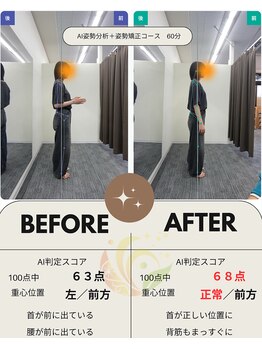 長町南ソラス整骨院/整体院/【猫背が気にならなくなった】