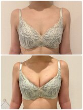 美人バスト 浜松店/◇ バストアップ &nbsp;BeforeAfter◇