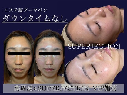 エスポワールカルド(Espoir caldo)の写真