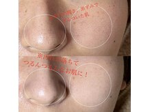 ソワ 吉塚店(soi)の雰囲気（施術後毎回びっくり！!お肌つるんつるんで驚異のトーンアップ☆）