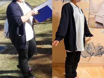 ヨサパーク 新百合ヶ丘店(YOSA PARK)/【before &after】