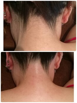 エン(en.)/BeforeAfter写真26