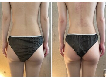 サプナジー(Suppnrgy)/カスタムトリートメント