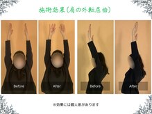 ボディ リセット アンド デザイン(Body Reset & Design)/【施術例】ビフォーアフター