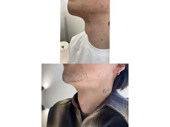 グランツ(GLANZ)/