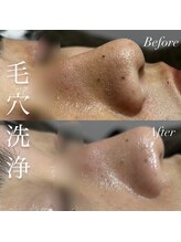 アース コアフュールボーテ 新潟紫竹山店(EARTH coiffure beaute)/毛穴洗浄
