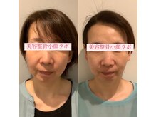 美容整骨小顔ラボ/小顔矯正×マシン