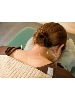 鍼灸施術を受けたい