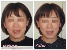 ドクター ヴィーナス/歪み改善の症例