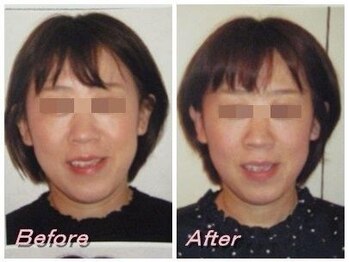 ドクター ヴィーナス/歪み改善の症例