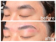 クラシックス(CLASSICS)/美眉wax脱毛