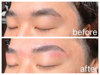 クラシックス(CLASSICS)/美眉wax脱毛