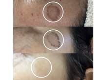 ニュアージュ(Nuage)