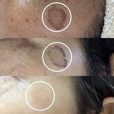 ニュアージュ(Nuage)