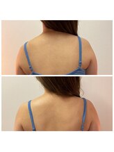 ミチカケ トリムリターン那覇市店/美しい肩のラインに！