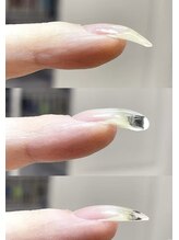 下向き爪のフォルム補正